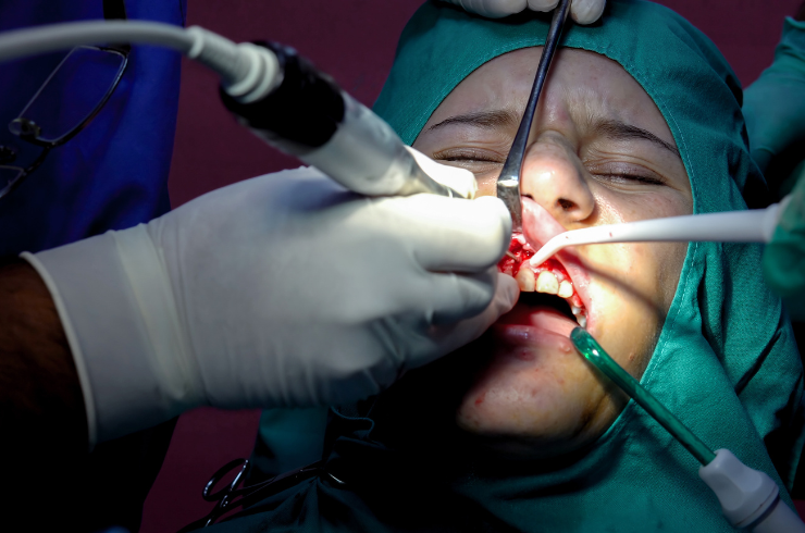 Cyst Removal